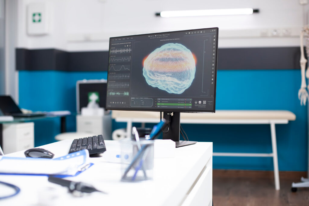 computer showing-brain image